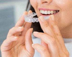 A woman smiling while seeing Invisalign treatment in Banjara hills, Hyderabad